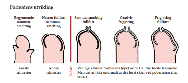 Fra Cupido Arkiv: Nyttig å vite om forhuden