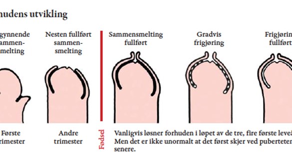 Fra Cupido Arkiv: Nyttig å vite om forhuden