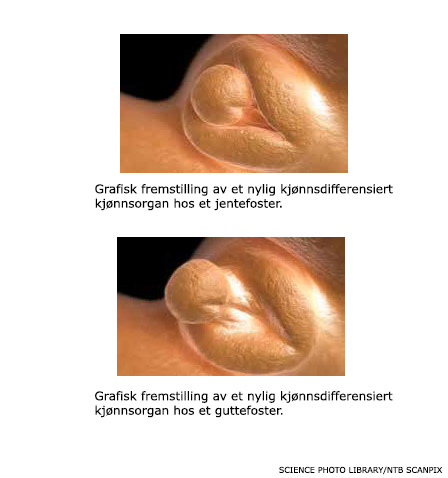 Kjønnsdifferensiering i fosterstadiet (2)